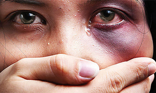 العنف ضد المرأة ومواجهته