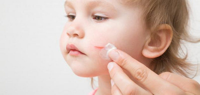 علاج خدوش الوجه بالأظافر للأطفال